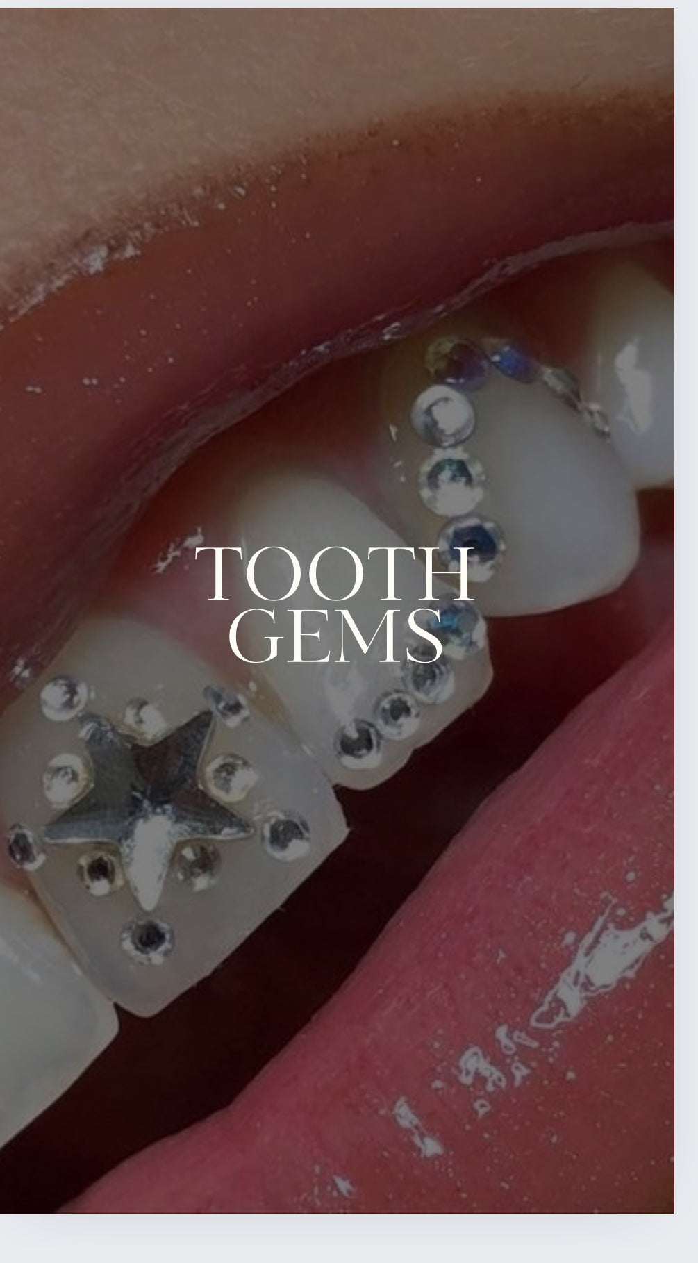 Tooth Gem Online Training Course